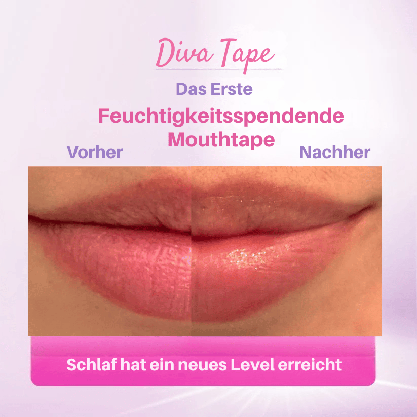 Diva Tape | Feuchtigkeit und Volumen spendendes Mouth Tape
