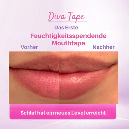 Diva Tape | Feuchtigkeit und Volumen spendendes Mouth Tape
