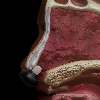 FreiAtmen™ Nasen-Rotlichttherapie
